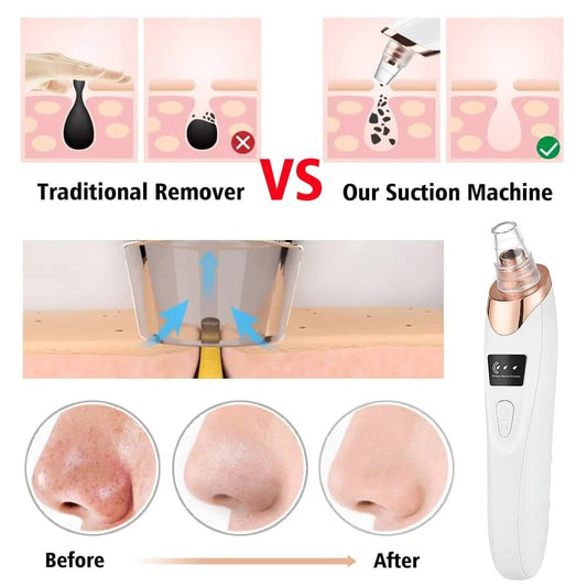 5-in-1 Pore Cleaner Pro Device